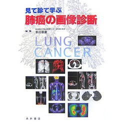 肺癌の画像診断―見て診て学ぶ [単行本]
