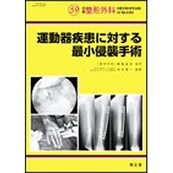 運動器疾患に対する最小侵襲手術（別冊整形外科 no.59） [単行本]