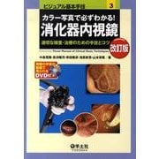 カラー写真で必ずわかる!消化器内視鏡 第2版－適切な検査・治療のための手技とコツ（ビジュアル基本手技 3） [単行本]
