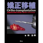 矯正移植 [単行本]