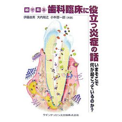 絵で見る歯科臨床に役立つ炎症の話―いまそこで何が起こっているのか? [単行本]