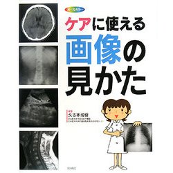 ケアに使える画像の見かた―X線写真・CT画像・エコー像・MRI [単行本]