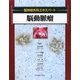脳動脈瘤(脳神経外科エキスパート) [単行本]