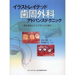 イラストレイテッド歯周外科アドバンステクニック : 再生療法とインプラントに挑む ヨドバシ.com - イラストレイテッド歯周外科アドバンス