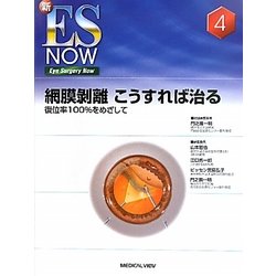 Amazon.com: 網膜剥離 こうすれば治る−復位率100%をめざして