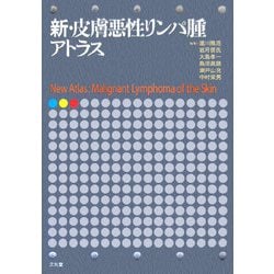 ヨドバシ.com - 新・皮膚悪性リンパ腫アトラス [単行本] 通販【全品