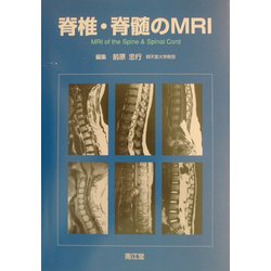 脊椎・脊髄のMRI [単行本]