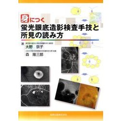 身につく蛍光眼底造影検査手技と所見の読み方 [単行本]