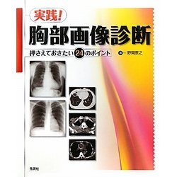 実践!胸部画像診断―押さえておきたい24のポイント 野間 恵之 ヨドバシ.com - 実践!胸部画像診断―押さえておきたい24の