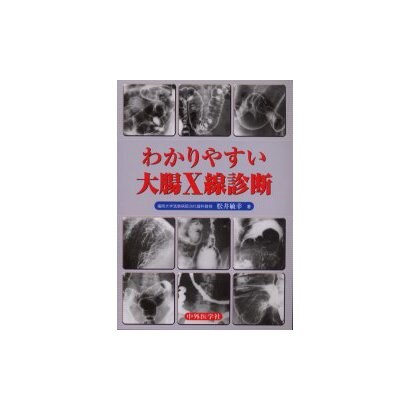 わかりやすい大腸X線診断 [単行本]