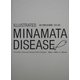 ILLUSTRATED MINAMATA DISEASE―絵で見る水俣病 [単行本]