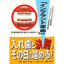 インプラント革命―即、噛める! [単行本]