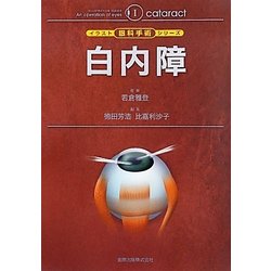 白内障(イラスト眼科手術シリーズ〈1〉) [単行本]