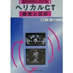 胸部疾患におけるヘリカルCT検査と読影 [単行本]