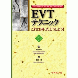 ヨドバシ.com - EVTテクニックこれは困ったどうしよう! [単行本] 通販【全品無料配達】