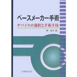 ペースメーカー手術―デバイスの選択と手術手技 [単行本]