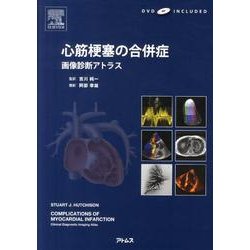 心筋梗塞の合併症 : 画像診断アトラス 心筋梗塞の合併症 画像診断アトラス DVD付き(中古品) 中古 自分力 生体