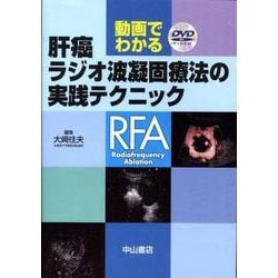 ヨドバシ.com - 動画でわかる肝癌ラジオ波凝固療法の実践テクニック