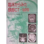 臨床からみた頭部CT・MRI [単行本]