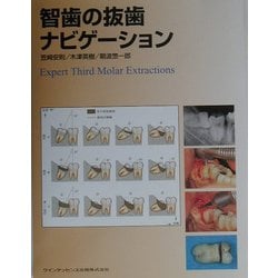 ヨドバシ.com - 智歯の抜歯ナビゲーション [単行本] 通販【全品無料配達】