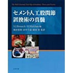 セメント人工股関節置換術の真髄 ヨドバシ.com - セメント人工股関節置換術の真髄 [単行本] 通販