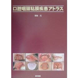 ヨドバシ.com - 口腔咽頭粘膜疾患アトラス [単行本] 通販【全品無料配達】