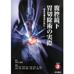 ヨドバシ.com - 腹腔鏡下胃切除術の実際―安全な普及のために [単行本] 通販【全品無料配達】