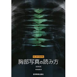 ヨドバシ.com - ゼッタイわかる胸部写真の読み方 改訂第3版 [単行本