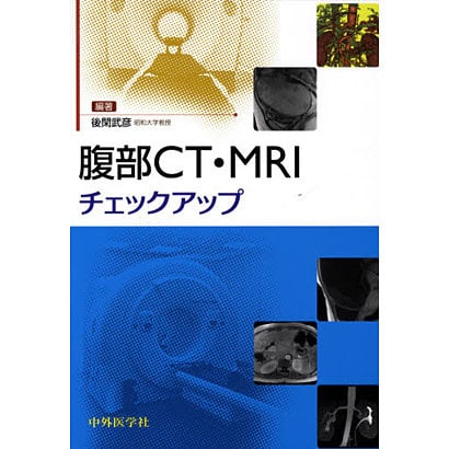 腹部CT・MRIチェックアップ [単行本]