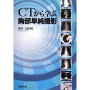 CTから学ぶ胸部単純撮影 [単行本]