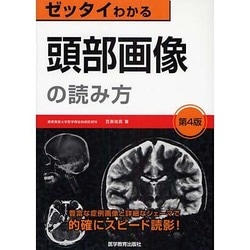 頭部画像の読み方 第4版 [単行本]