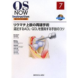 リウマチ上肢の再建手術 満足するＡＤＬ・ＱＯＬを獲得する手技のコツ  /メジカルビュ-社/金谷文則（単行本） ヨドバシ.com - リウマチ上肢の再建手術―満足するADL・QOLを獲得