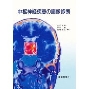 中枢神経疾患の画像診断 [単行本]