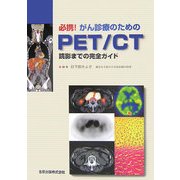 必携!がん診療のためのPET/CT―読影までの完全ガイド [単行本]