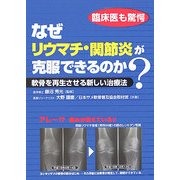 なぜリウマチ・関節炎が克服できるのか?―軟骨を再生させる新しい治療法 [単行本]