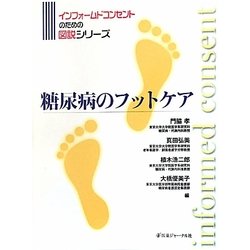 糖尿病のフットケア(インフォームドコンセントのための図説シリーズ) [単行本]