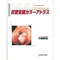 気管支鏡カラーアトラス [単行本]