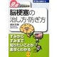 脳梗塞の治し方・防ぎ方(専門医が図解するシリーズ快速まるわかり) [全集叢書]