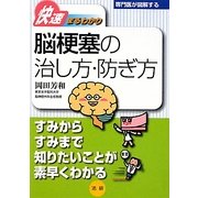 脳梗塞の治し方・防ぎ方(専門医が図解するシリーズ快速まるわかり) [全集叢書]