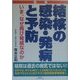 図解 結核の感染・発病と予防―いま、なぜ再び脅威なのか [単行本]
