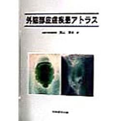 外陰部皮膚疾患アトラス 41g9N55aKkL._AC_SY200_QL15_.jpg