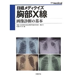 胸部X線―画像診断の基本(日経メディクイズ) [単行本]