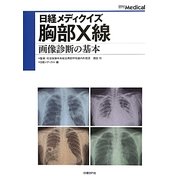胸部X線―画像診断の基本(日経メディクイズ) [単行本]