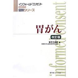 胃がん 改訂版 (インフォームドコンセントのための図説シリーズ) [単行本]