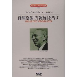 自然療法で「乾癬」を治す(エドガー・ケイシー文庫) [単行本]