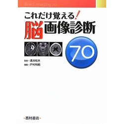 これだけ覚える!脳画像診断70 [単行本]