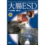 大腸ESD [単行本]