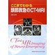 ここまでわかる頭部救急のCT・MRI [単行本]