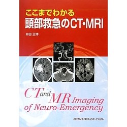 ここまでわかる頭部救急のCT・MRI [単行本]