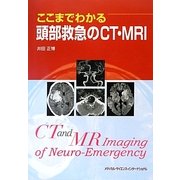 ここまでわかる頭部救急のCT・MRI [単行本]